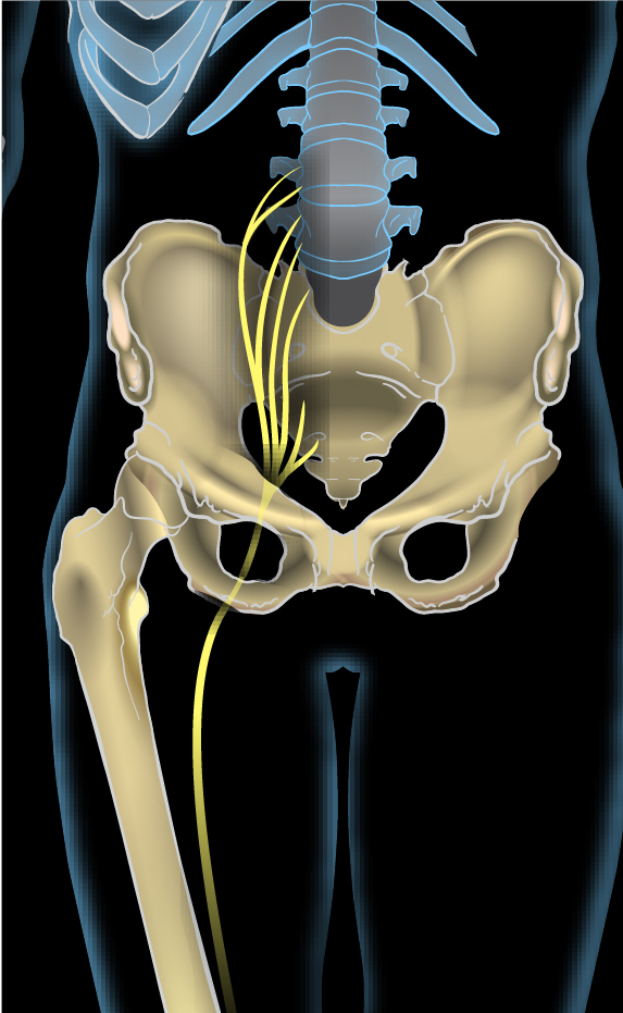 Sciatic nerve, anterior view• Author: K. D. Schroeder • Sciatic nerve2.jpg from Wikimedia Commons • License: Creative Commons Attribution-ShareAlike 4.0, https://en.wikipedia.org/wiki/Sciatica#/media/File:Sciatic_nerve2.jpg